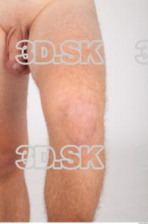 Knee texture of Aurel 0002